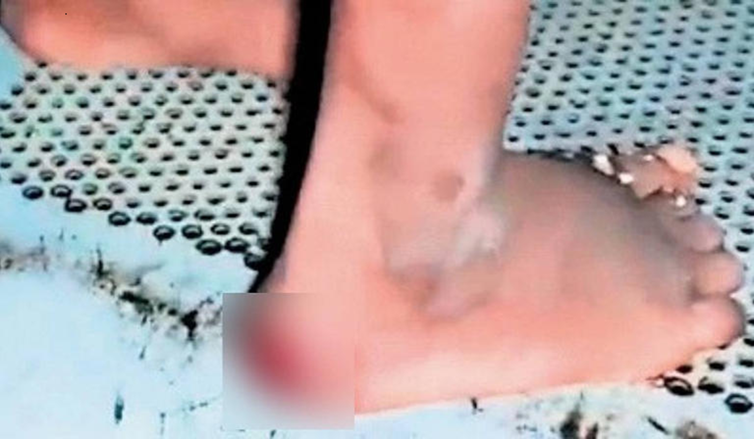Telangana couple arrested for child abuse, thrashed them with hot iron rods