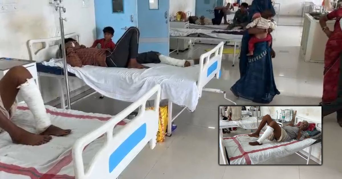 Cellulitis cases rise in Madhya Pradesh’s Rajgarh, over 70 patients reported in a month